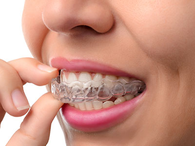 Amy L. Zuker, DMD | Dental Bridges, Orthodontics and Preventative Program